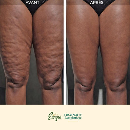 Solution Eunysa™ pour Drainage Lymphatique Liquide – Visage Affiné, Jambes Légères, Ventre Plat