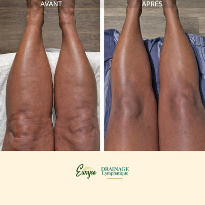 Solution Eunysa™ pour Drainage Lymphatique Liquide – Visage Affiné, Jambes Légères, Ventre Plat